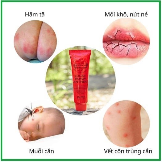 Bùng nổ nâng cấp mới Kem đu đủ đa năng Úc Lucas Papaw Ointment 25gr/75gr