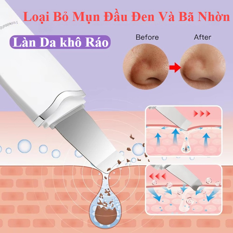 Máy Sủi Da Chết Siêu âm – Công Nghệ Ultrasonic, Loại Bỏ Mụn đầu đen Và Tế Bào Chết, Làm Sạch Sâu Mà Không Gây đau Rát