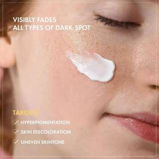 Youbuy Freckle Whitening Cream Remove Dark Spots Anti Freckle Cream 20g