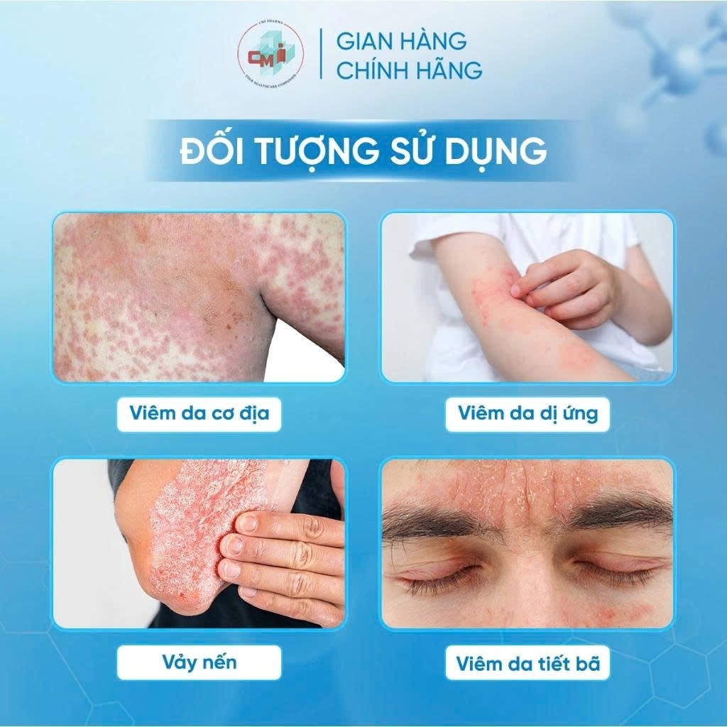 Blue Cap Spray 50ml dạng xịt hỗ trợ giảm vảy nến, viêm da cơ địa, viêm da tiết bã, viêm da dị ứng