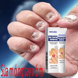 Kem phục hồi móng Móng kháng khuẩn chân loại nấm móng gãy móng chống Kem giúp hết nấm làm thối móng tay móng chân Tinh c