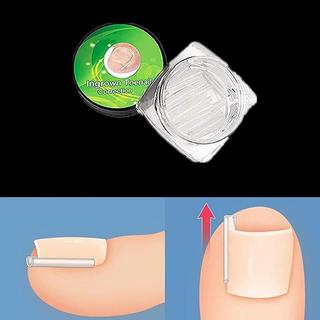 [Firefly] 50 Cái Dụng cụ chỉnh sửa móng chân mọc ngược Điều trị móng chân Chân mọc ngược Miếng dán đàn hồi Miếng dán thẳng Kẹp nẹp Dụng cụ làm móng chân [VN]