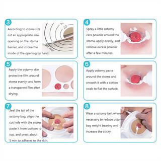 【COD】Sản phẩm túi đựng dịch hậu môn nhân tạo chất lượng cao, bộ 10 túi tiết kiệm, thích hợp cho bệnh nhân sau phẫu thuật