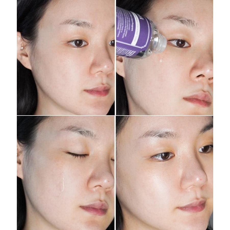 Nước Hoa Hồng Không Mùi Dưỡng Ẩm Và Làm Mềm Da Dear Klairs Supple Preparation Unscented Toner 180ml