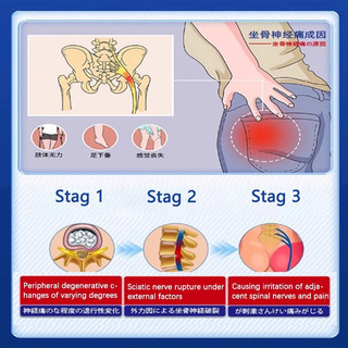 Miếng dán giảm đau thần kinh tọa Nhật Bản, giảm đau lưng, cột sống, 12 chiếc