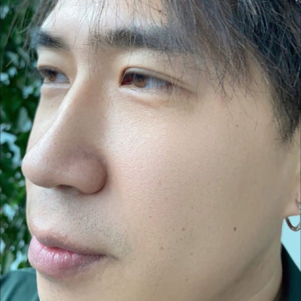 Kem Nám Mờ Thâm MIESHO HA Dưỡng Da Mỗi Ngày Cải Thiện Vùng Da Tối Màu Nâng Tông Nhẹ Nhàng Bộ 4 Món