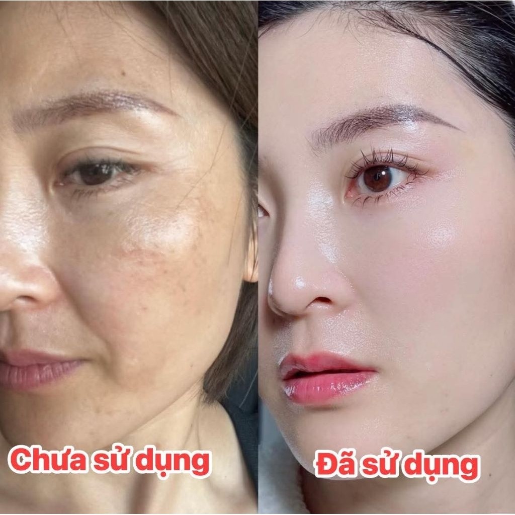 Serum Cấp Ẩm KONIGIN Dưỡng Da Mềm Mịn Hỗ Trợ Làm Dịu Da Cân Bằng Độ Ẩm Cho Da Chai 18g