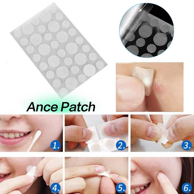 Shine🍊Salicylic Acid 36 Miếng Dán Hạt Mụn Miếng Dán la Vô Hình Mụn Loại Bỏ Dấu Vết Mụn Miếng Dán