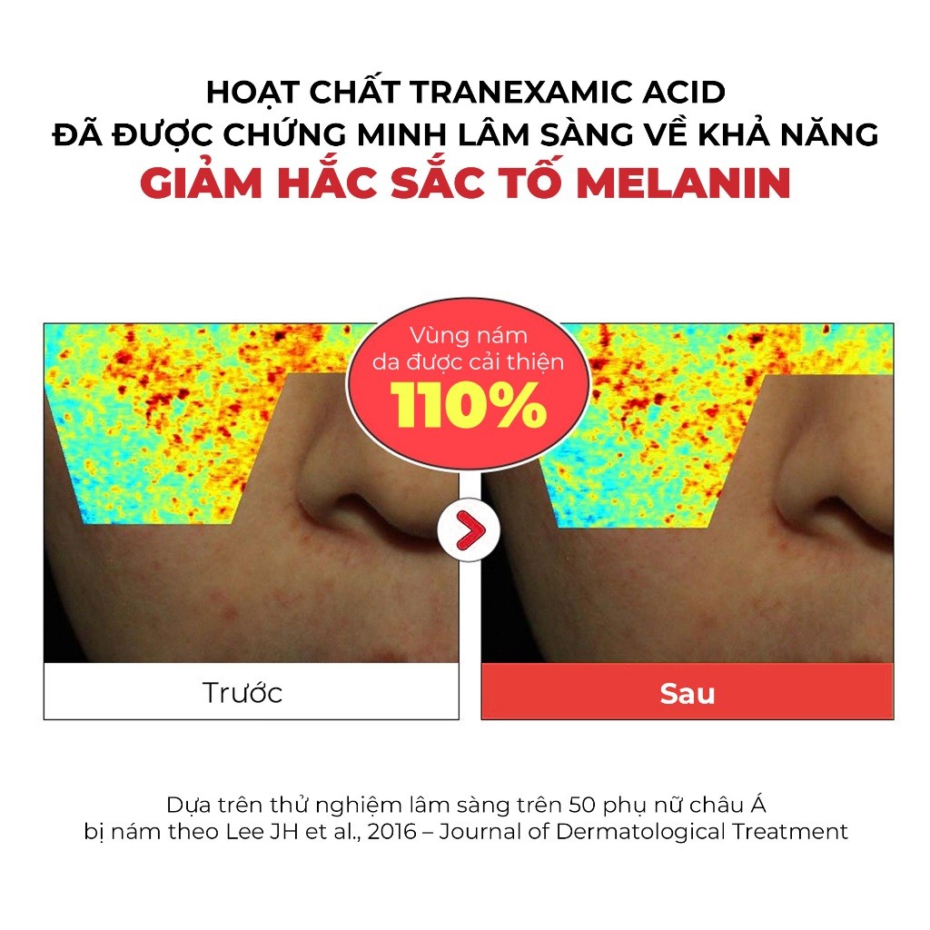 Serum Dưỡng Trắng Mờ Thâm Nám Tia’m Tranexin Nia Vita Serum 40ml | BigBuy360 - bigbuy360.vn