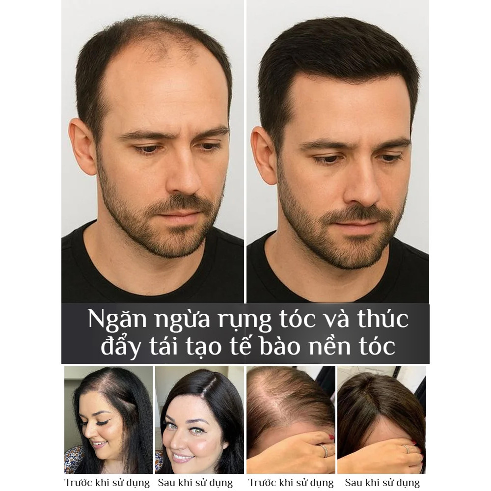 Sử Dụng Cái Ô Trong Đời Sống