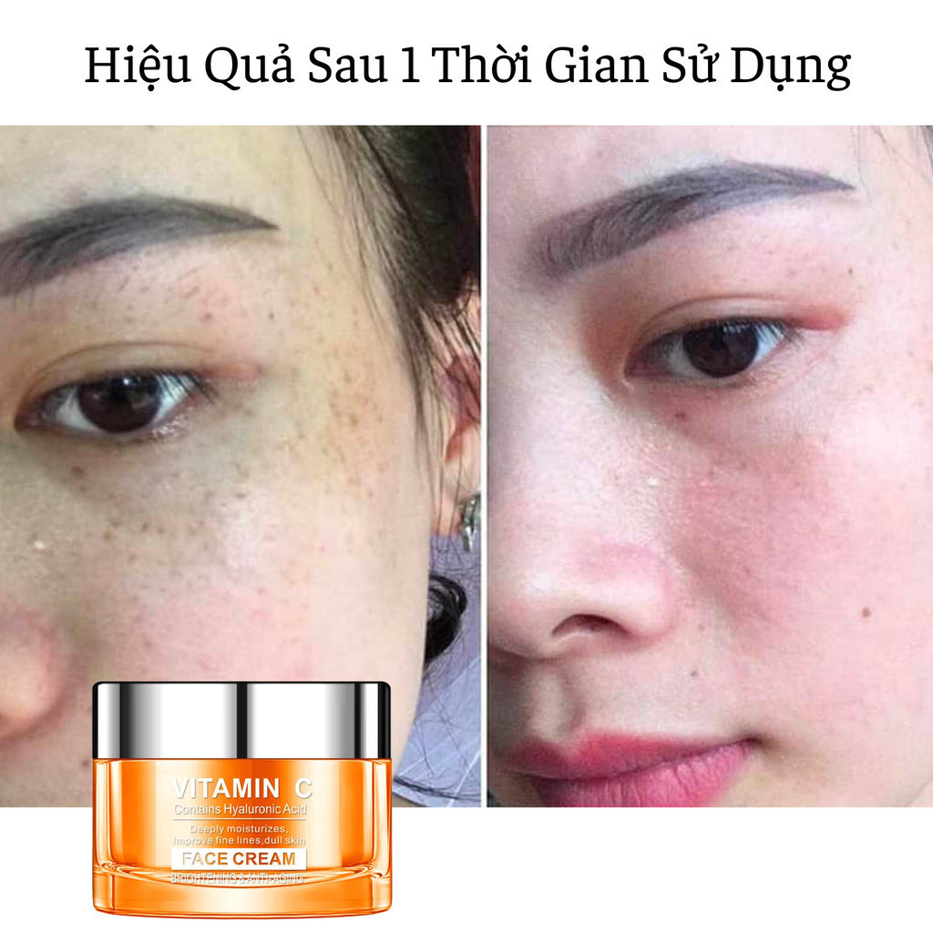 Kem Dưỡng Da Mặt DR.DAVEY Vitamin C Làm Trắng Sáng Dưỡng Ẩm Làm Săn Chắc Phục Hồi