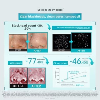 ILSO Nước hỗ trợ giảm mụn đầu đen, kiểm soát dầu, thu nhỏ lỗ chân lông, dưỡng ẩm, làm sạch sâu
