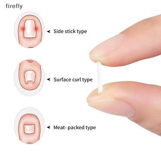 [Firefly] 50 Cái Dụng cụ chỉnh sửa móng chân mọc ngược Điều trị móng chân Chân mọc ngược Miếng dán đàn hồi Miếng dán thẳng Kẹp nẹp Dụng cụ làm móng chân [VN]
