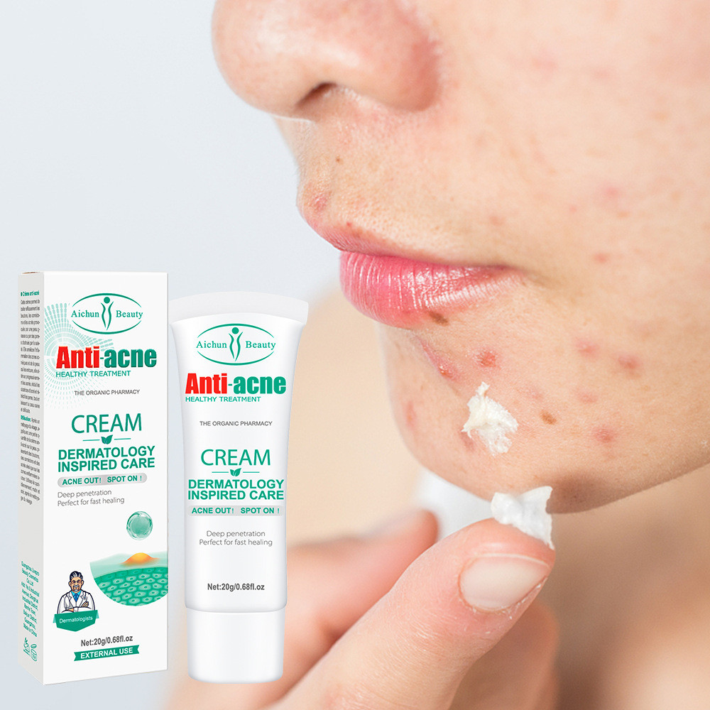Kem Chuyên Biệt Giảm Thâm Mụn Chuyên Sâu Anti-Acne Sạch Mụn, Mờ Thâm 20gm