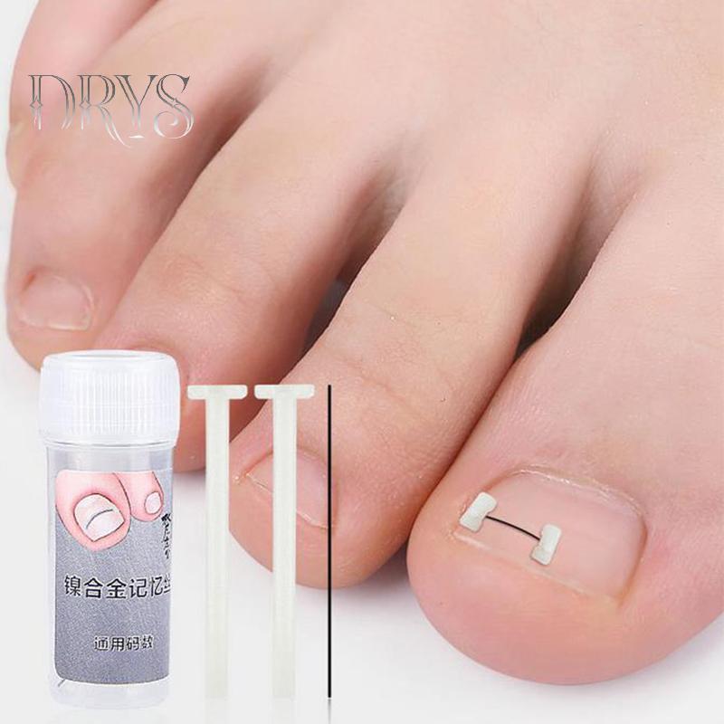 Dụng cụ chỉnh sửa móng mọc ngược, phục hồi móng, chăm sóc bàn chân chuyên nghiệp