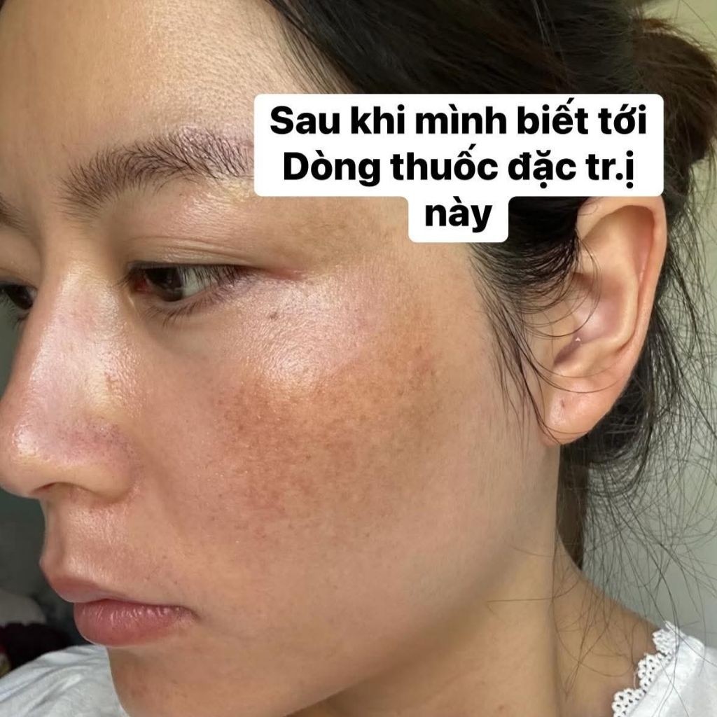 Kem Nám Mờ Thâm Konigin Hỗ Trợ Mờ Thâm Nám, Dưỡng Trắng, Cấp Ẩm Phục Hồi Da Bộ 2 Món