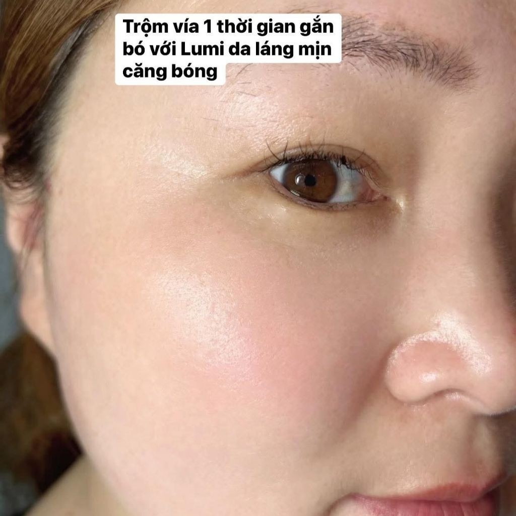 Kem Nám Mờ Thâm Ngày Đêm Lumi Arbutin  Giảm Thâm Nám, Sáng Da, Đều Màu Bộ 4 Món