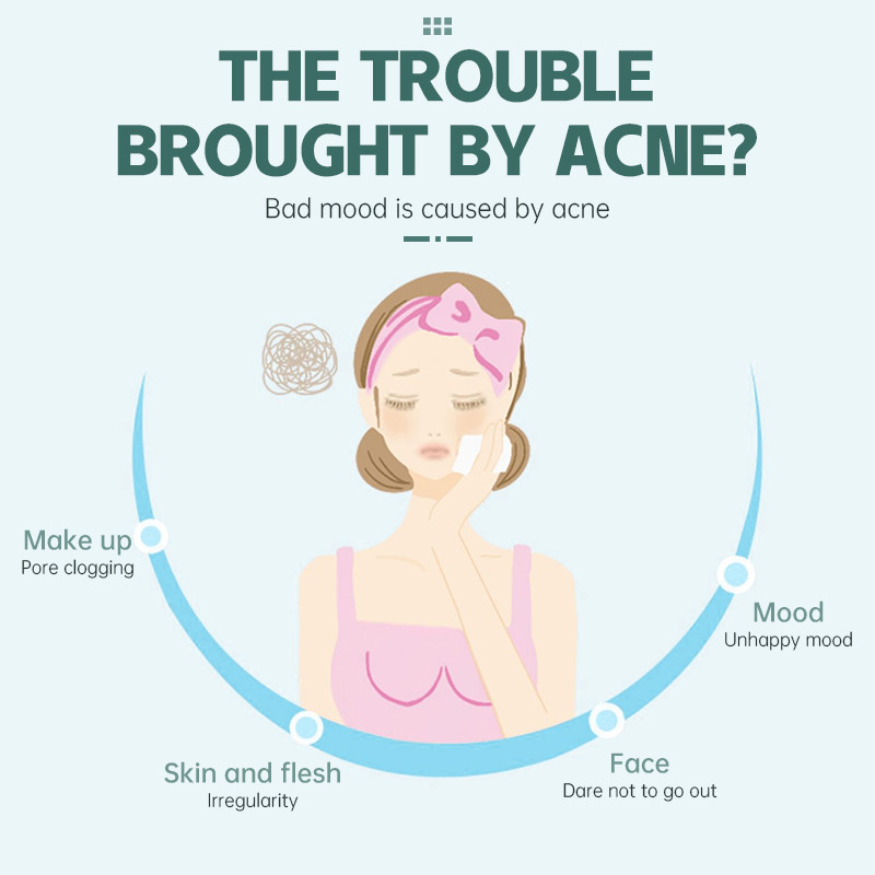 【Roshy】36 miếng/tờ Trị mụn Miếng dán trị mụn Miếng dán Chăm sóc da Axit Salicylic