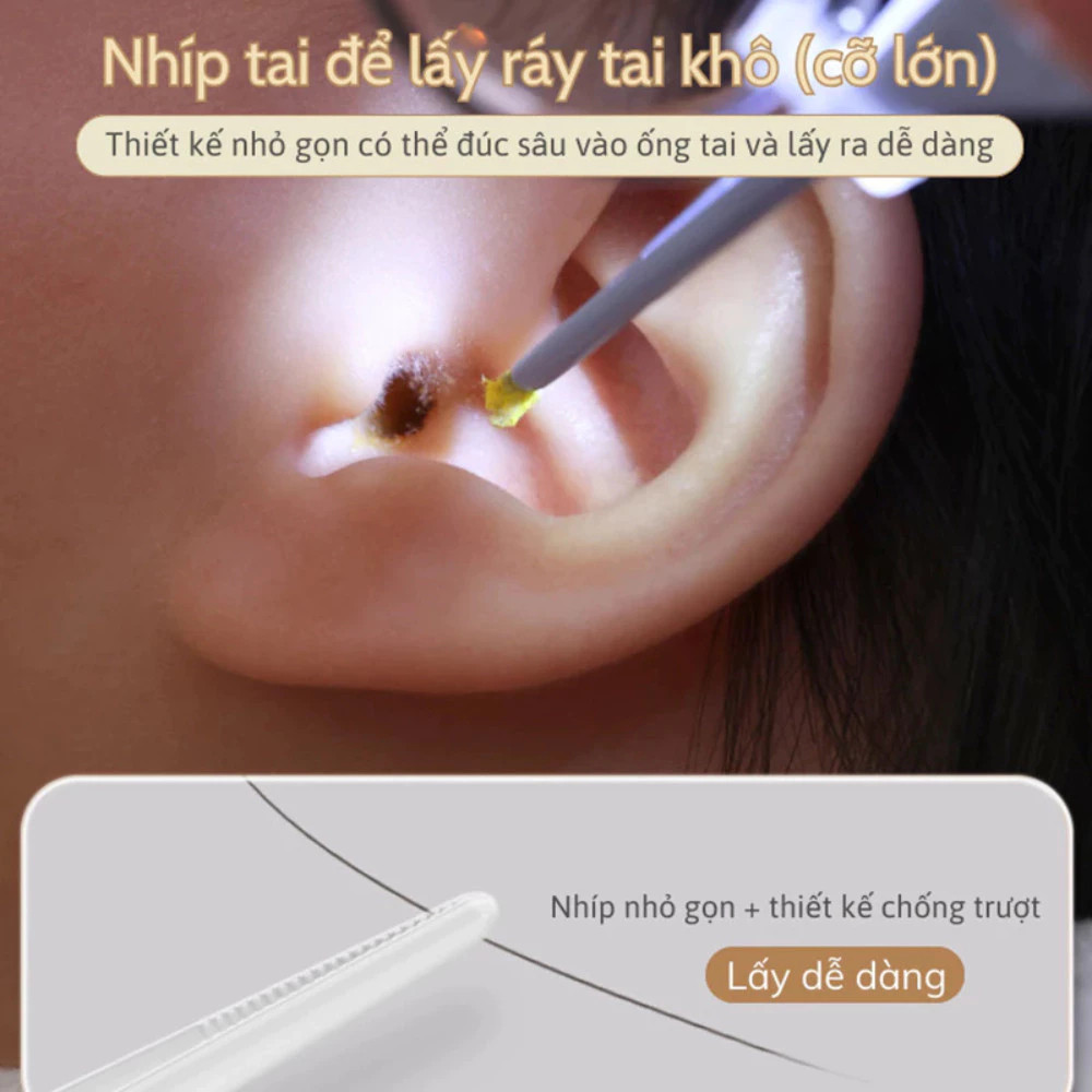 Bộ Lấy Ráy Tai Có Đèn LED HomeMate – Đầu Silicon Mềm An Toàn Cho Bé, Kèm Nhíp & Sạc USB Không Dây