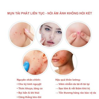 Star Acne Patches 200 Chiếc Vô Hình Hydrocolloid Chăm Sóc Điểm Da Làm Dịu Người Lớn Tuổi Teen Sử Dụng