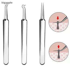 Bigapple 8CM Nhíp Mụn Đầu Đen Kẹp Mụn Dụng Cụ Loại Bỏ Mụn Thẩm Mỹ Viện Cạo Kim RDG