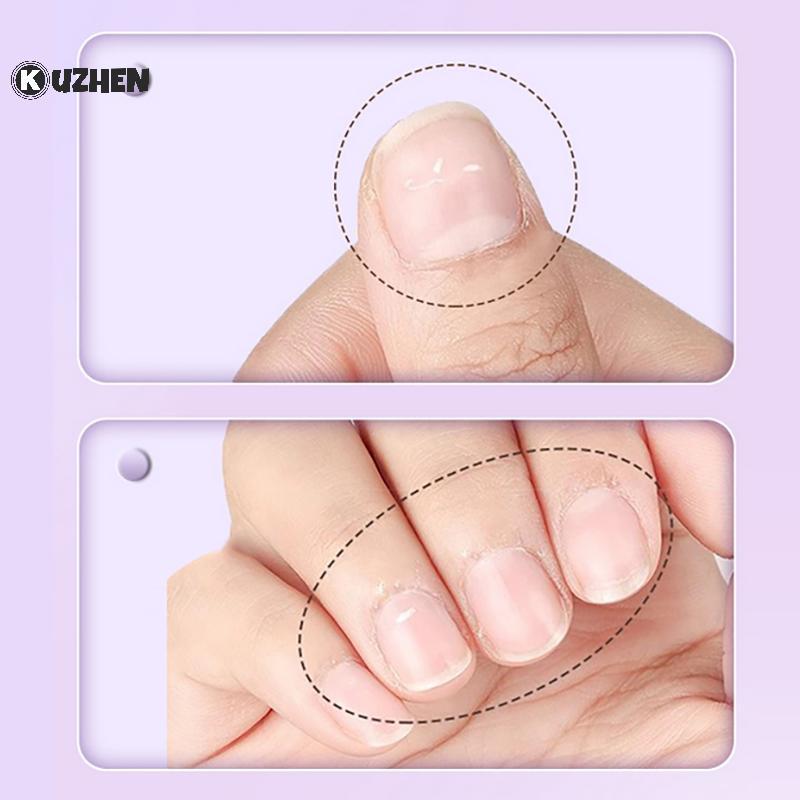 KUZHEN Anti-barb Nail Cuticle Oil Dưỡng ẩm Nuôi dưỡng Móng tay Loại bỏ lớp biểu bì Bút làm sáng da Chăm sóc móng tay Bút tinh chất cho móng tay hư hỏng HOT