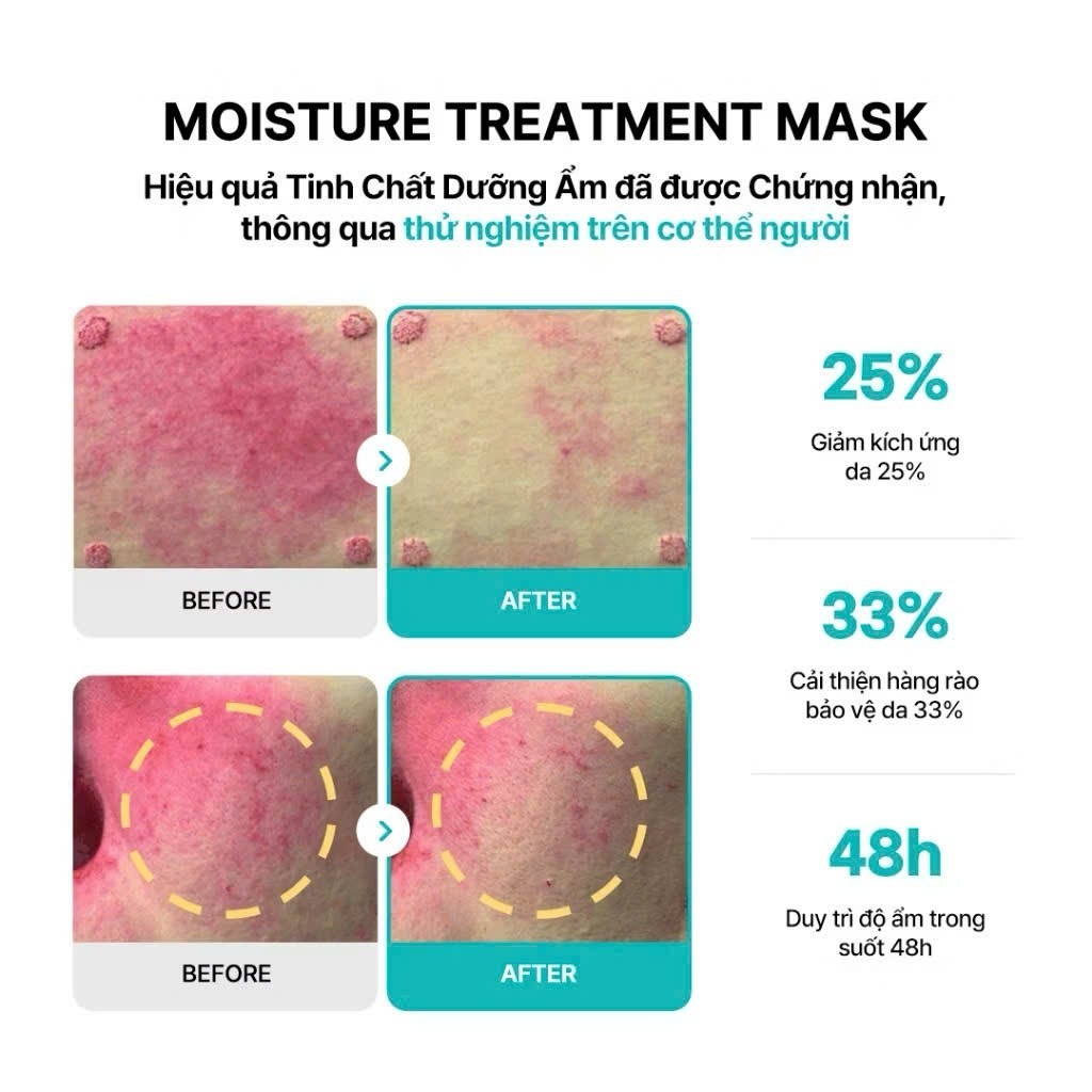 Mặt nạ REJURAN Moisture Treatment Mask PDRx 5% dưỡng ẩm phục hồi cho da nhạy cảm
