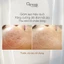 Tinh chất C sửa chữa DNA - Osmosis Catalyst MD Advanced Repair C Serum 30ml chính hãng