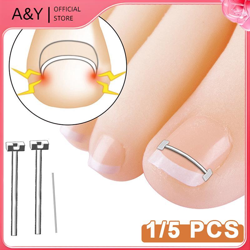 Dụng cụ chỉnh sửa móng chân mọc ngược A & Y Phục hồi móng chân Dụng cụ kẹp móng chân mọc ngược chuyên nghiệp.