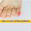 Silicone Ngón Tay Mũi Nắp Bảo Vệ Bao Tay Cái Ngô Vỉ Giảm Đau Ngón Chân Ống Bunion Chỉnh Chăm Sóc Bàn Chân