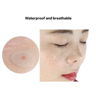 SAFENH 36 Miếng Dán Mụn Hydrocolloid Miếng Dán Che Khuyết Điểm Điều Hỗ trợ giảm mụn Chống Thấm Nước VN