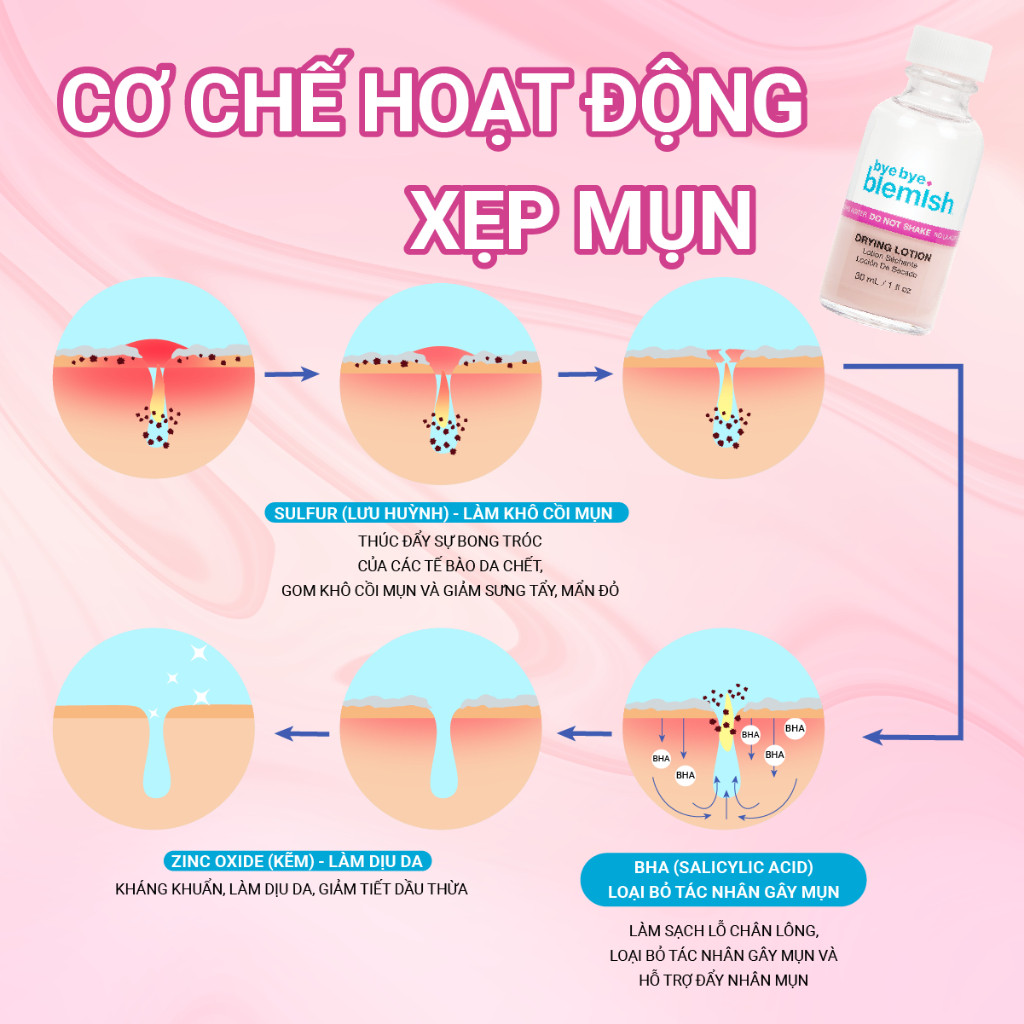 [SALE 7.7] Chấm Mụn 2 Lớp Giảm Mụn Nhanh Sau 1 Đêm Bye Bye Blemish Drying Lotion 30ml Cho Tất Cả Loại Mụn