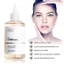 The Ordinary Glycolic Acid 7% Toner 240ml | Giảm Mụn, Kiểm Soát Dầu, Mịn Da