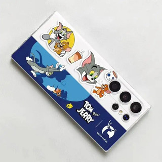 🔷Ốp lưng Samsung họa tiết thẩm mỹ, vỏ trong suốt không ố vàng, chống va đập hoàn hảo, phong cách thời trang độc đáo