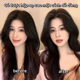 Lược Làm Phồng Chân Tóc, Kẹp Tạo Phồng Chân Tóc Mái Thời Trang Hàn Quốc 3 Răng, 6 Răng Cho Nam Nữ