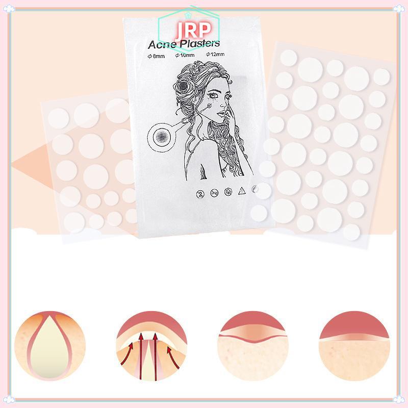 JRP 24 / 36 Miếng Dán Hydrocolloid Pimple Miếng Dán Tròn Màu Trắng Chống Thấm Nước Hình Điểm Pimple Điều Trị Che Khuyết Điểm Miếng Dán JRP
