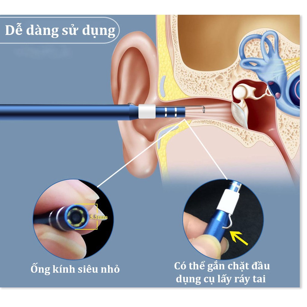 Bộ Dụng Cụ Lấy Ráy Tai Có Camera 3 In 1 RT01 Nội Soi Tai Mũi Họng Có App Kết Nối Với Điện Thoại Androi
