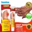 Kem Bôi Gout, Gút, Viêm Đầu Thống – GOUT RELIEF CREAM – 100% Thảo Mộc AN TOÀN KHÔNG HẠI GAN THẬN-GIÁ CỰC RẺ |ZQ