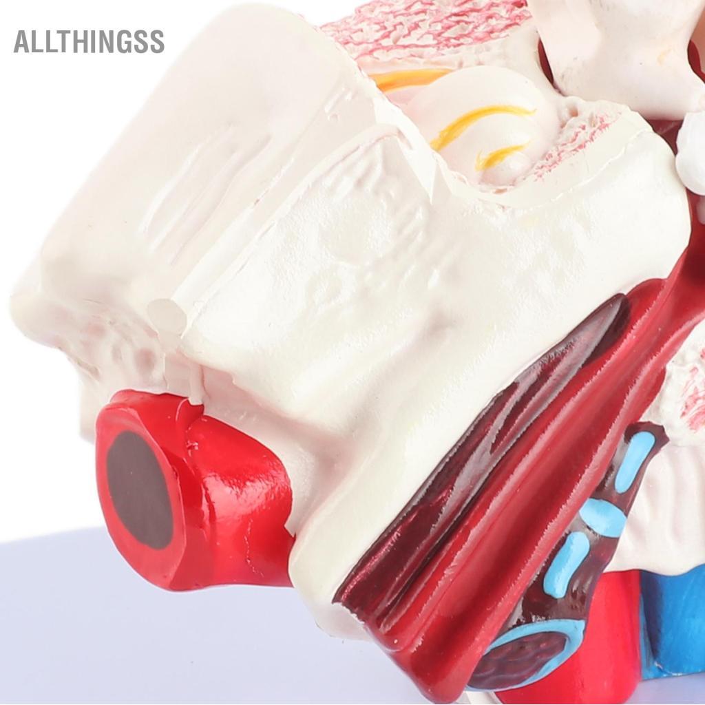 Allthingss Mô Hình Tai Giải Phẫu Khoa Học Chuyên Nghiệp Phóng Đại 1.5:1 Cho Phòng Thí Nghiệm Trường Học Bệnh Viện