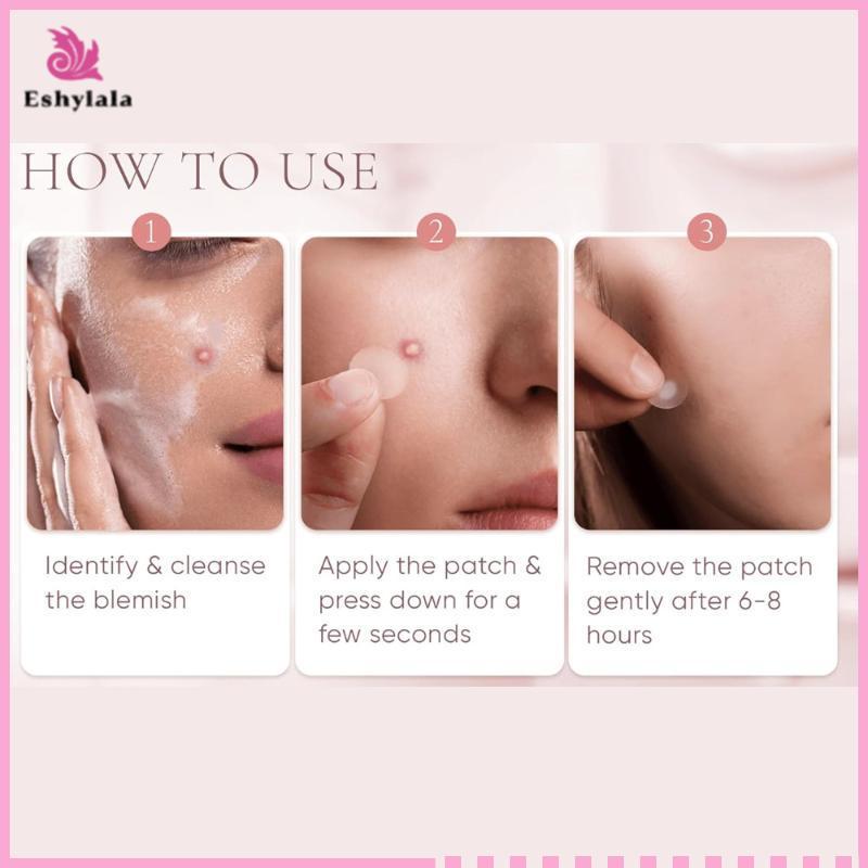 Eshylala Hydrocolloid Miếng Dán Mụn Lớn Nhiều Hình Dạng Vô Hình Bao Da Mụn Cho Cơ Thể Mặt [MỚI]