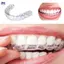 XOITOP Silicone Miệng Bảo Vệ Răng Bảo Vệ Ban Đêm Miệng Khay Cho Bệnh Bruxism Mài Chống Nhồi Răng Làm Trắng Da Bảo Vệ VN