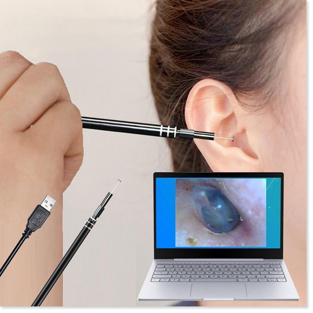 Bộ Dụng Cụ Lấy Ráy Tai Có Camera 3 In 1 RT01 Nội Soi Tai Mũi Họng Có App Kết Nối Với Điện Thoại Androi