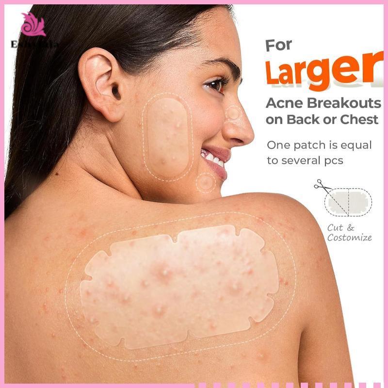 Eshylala Hydrocolloid Miếng Dán Mụn Lớn Nhiều Hình Dạng Vô Hình Bao Da Mụn Cho Cơ Thể Mặt [MỚI]
