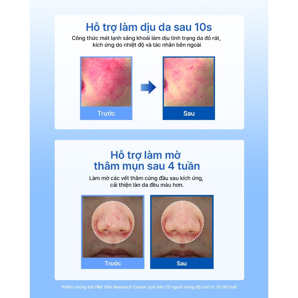 [ĐQ][DATE T6-T11/27] Kem dưỡng ẩm Dear, Klairs Midnight Blue Clearing Water Cream hỗ trợ tái tạo da 50g