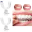 XOITOP Silicone Miệng Bảo Vệ Răng Bảo Vệ Ban Đêm Miệng Khay Cho Bệnh Bruxism Mài Chống Nhồi Răng Làm Trắng Da Bảo Vệ VN