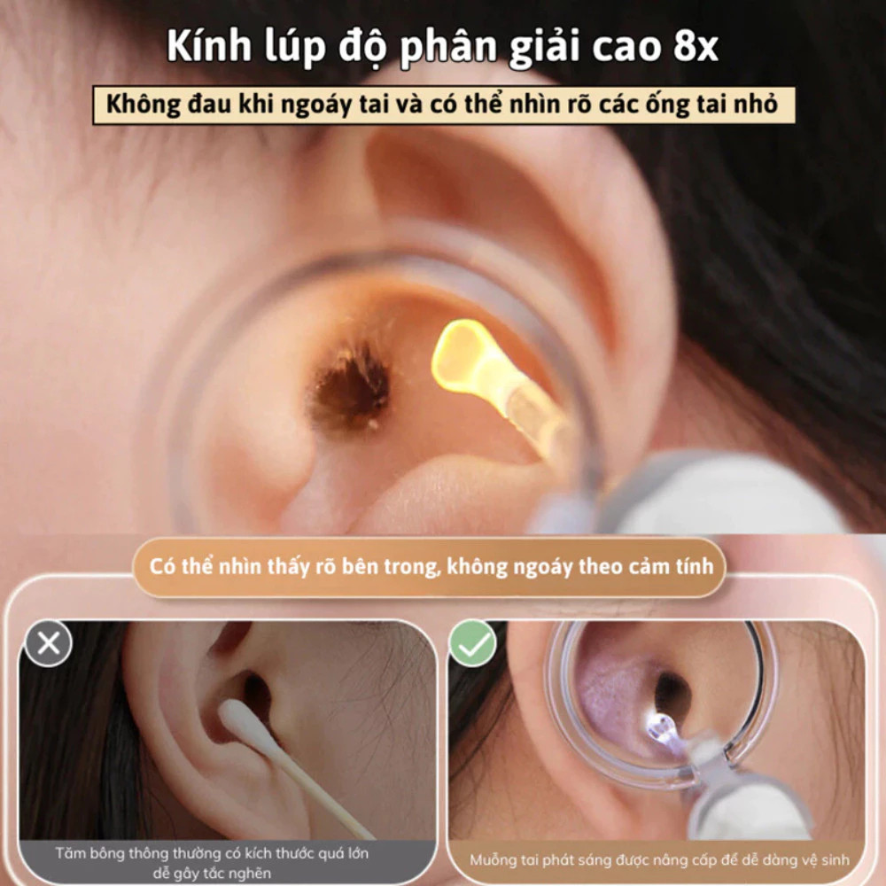 Bộ Lấy Ráy Tai Có Đèn LED HomeMate – Đầu Silicon Mềm An Toàn Cho Bé, Kèm Nhíp & Sạc USB Không Dây
