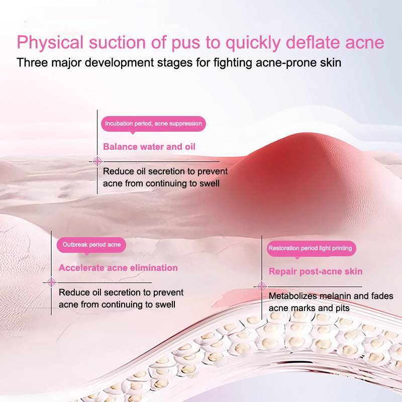HFSHY 360 CÁI Loại bỏ mụn vô hình đầy màu sắc Chống mụn Hydrocolloid Patch Không gây kích ứng Sửa chữa Stier VN
