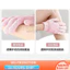 {READY STOCK} Găng tay tắm năm ngón Chà dụng cụ tiện dụng Phòng tắm gia đình kháng khuẩn Tẩy tế bào chết nam nữ chuyên dụng không làm tổn thương da