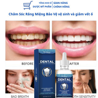 Dung dịch chăm sóc răng miệng cao cấp, Làm trắng và tăng cường men răng, Đánh Bay Sâu Răng, Ê Buốt Răng, Răng Chắc