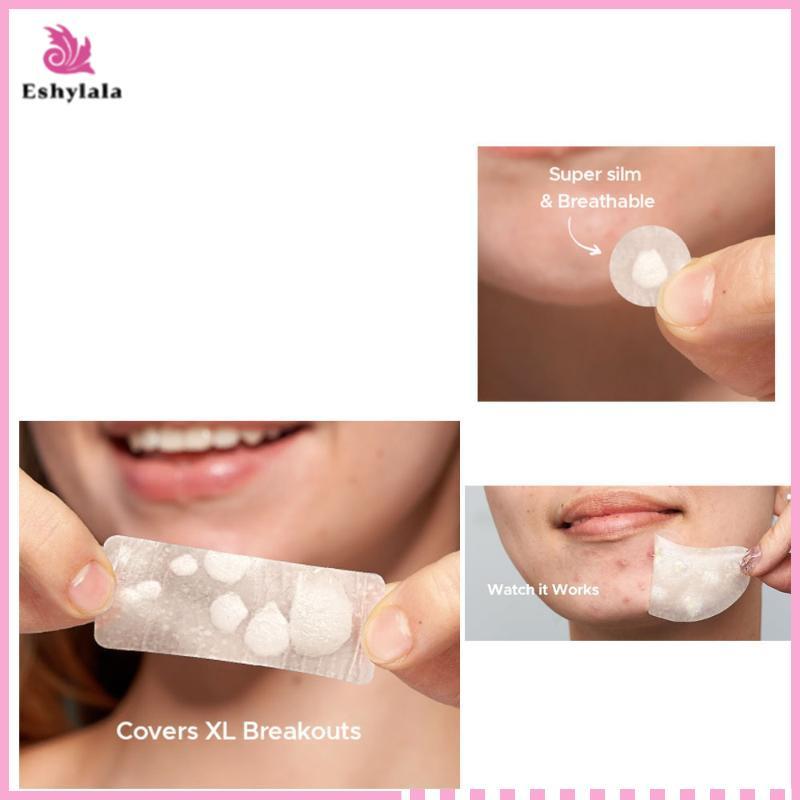 Eshylala Hydrocolloid Miếng Dán Mụn Lớn Nhiều Hình Dạng Vô Hình Bao Da Mụn Cho Cơ Thể Mặt [MỚI]